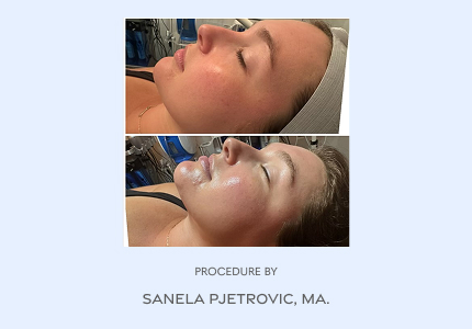 Before and After