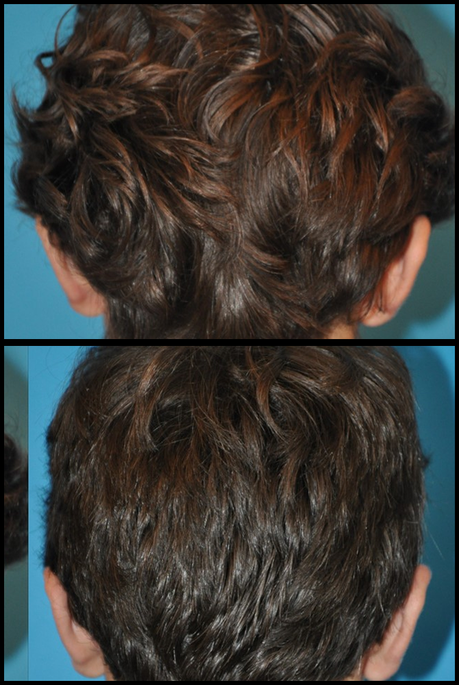 Before and After