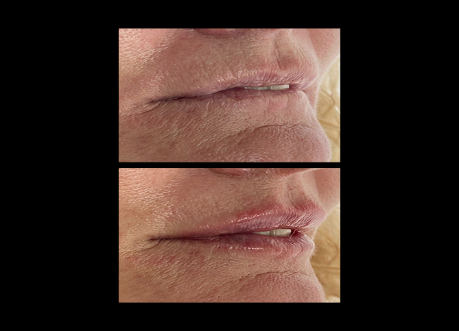 Before and After