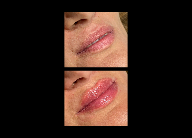 Before and After
