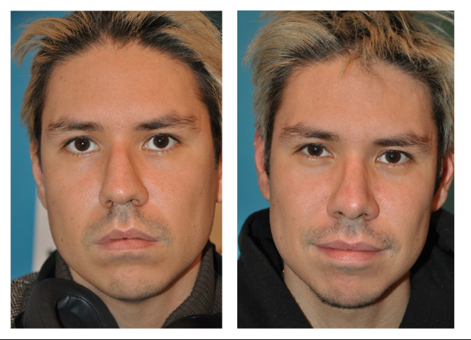 Before and After