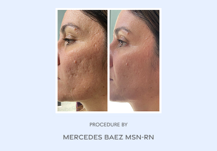 Before and After