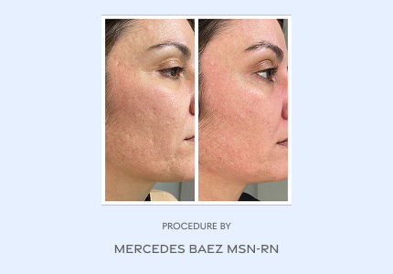 Before and After
