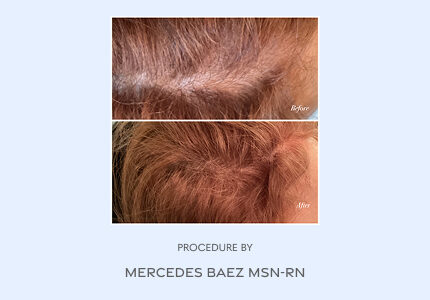 Before and After